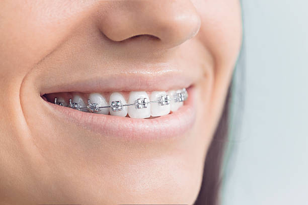 Best Traditional Braces  in Beaver, WV